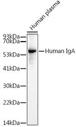 Human IgA Antibody in Western Blot (WB)