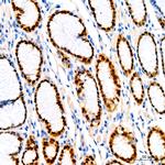 SOX9 Antibody in Immunohistochemistry (Paraffin) (IHC (P))