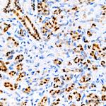 SOX9 Antibody in Immunohistochemistry (Paraffin) (IHC (P))