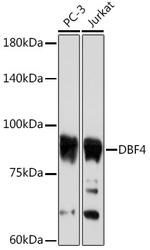 ASK Antibody in Western Blot (WB)