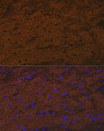 TMOD2 Antibody in Immunocytochemistry (ICC/IF)