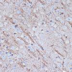 TMOD2 Antibody in Immunohistochemistry (Paraffin) (IHC (P))