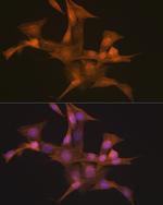 Nesprin 1 Antibody in Immunocytochemistry (ICC/IF)