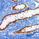 SATB2 Antibody in Immunohistochemistry (Paraffin) (IHC (P))