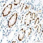 SATB2 Antibody in Immunohistochemistry (Paraffin) (IHC (P))