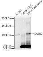 SATB2 Antibody in Immunoprecipitation (IP)