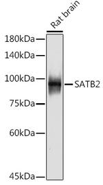 SATB2 Antibody in Western Blot (WB)