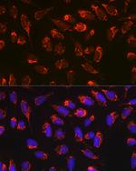 BAX Antibody in Immunocytochemistry (ICC/IF)