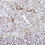 NEFL Antibody in Immunohistochemistry (Paraffin) (IHC (P))