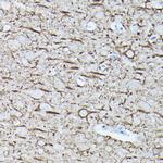 NEFL Antibody in Immunohistochemistry (Paraffin) (IHC (P))