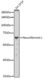 NEFL Antibody in Western Blot (WB)