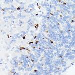 Somatostatin Antibody in Immunohistochemistry (Paraffin) (IHC (P))