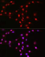 MCM2 Antibody in Immunocytochemistry (ICC/IF)