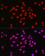 MCM2 Antibody in Immunocytochemistry (ICC/IF)