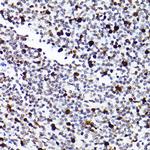 MCM2 Antibody in Immunohistochemistry (Paraffin) (IHC (P))