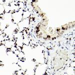 MCM2 Antibody in Immunohistochemistry (Paraffin) (IHC (P))