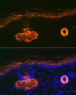 ApoC3 Antibody in Immunohistochemistry (Paraffin) (IHC (P))