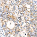 MRP1 Antibody in Immunohistochemistry (Paraffin) (IHC (P))