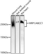 MRP1 Antibody in Western Blot (WB)