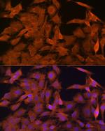 SRP54 Antibody in Immunocytochemistry (ICC/IF)