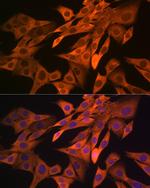 SRP54 Antibody in Immunocytochemistry (ICC/IF)