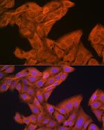 SRP54 Antibody in Immunocytochemistry (ICC/IF)