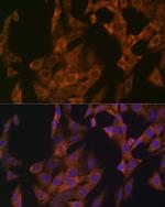 Zyxin Antibody in Immunocytochemistry (ICC/IF)