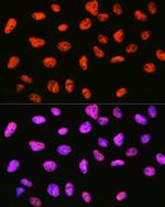 SIN3A Antibody in Immunocytochemistry (ICC/IF)