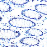 SIN3A Antibody in Immunohistochemistry (Paraffin) (IHC (P))