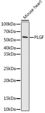 PGF Antibody in Western Blot (WB)