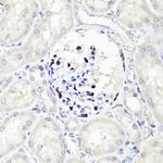 WT1 Antibody in Immunohistochemistry (Paraffin) (IHC (P))