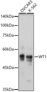 WT1 Antibody in Western Blot (WB)