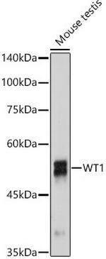 WT1 Antibody in Western Blot (WB)