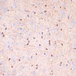 Gelsolin Antibody in Immunohistochemistry (Paraffin) (IHC (P))