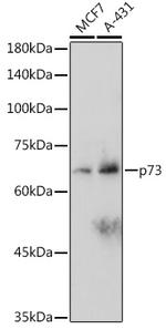 p73 Antibody in Western Blot (WB)