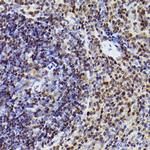 MEF2A/MEF2C Antibody in Immunohistochemistry (Paraffin) (IHC (P))