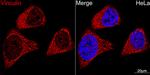 Vinculin Antibody in Immunocytochemistry (ICC/IF)