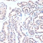 Nkx2.1 Antibody in Immunohistochemistry (Paraffin) (IHC (P))