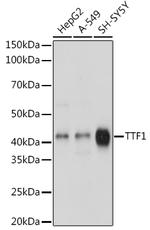 Nkx2.1 Antibody in Western Blot (WB)