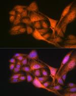 GLI3 Antibody in Immunocytochemistry (ICC/IF)