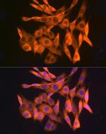 GLI3 Antibody in Immunocytochemistry (ICC/IF)