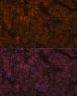 ADAMTS13 Antibody in Immunohistochemistry (Paraffin) (IHC (P))