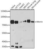 Menin Antibody in Western Blot (WB)