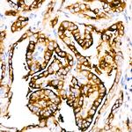 Thyroglobulin Antibody in Immunohistochemistry (Paraffin) (IHC (P))