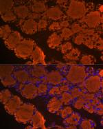 Thyroglobulin Antibody in Immunohistochemistry (Paraffin) (IHC (P))