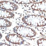 MUC4 Antibody in Immunohistochemistry (Paraffin) (IHC (P))