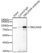 TBK1 Antibody in Immunoprecipitation (IP)