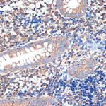 CRMP5 Antibody in Immunohistochemistry (Paraffin) (IHC (P))