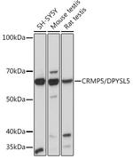 CRMP5 Antibody in Western Blot (WB)