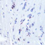 YBX1 Antibody in Immunohistochemistry (Paraffin) (IHC (P))